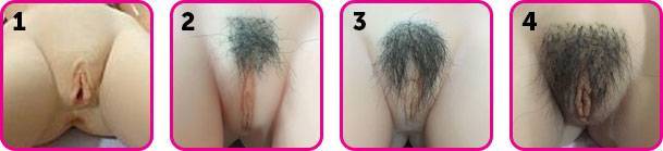 Pubic_hair1.jpg